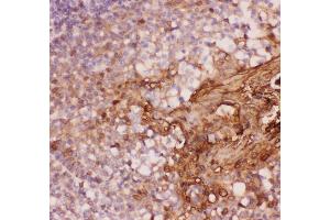 Anti-Annexin A1 Picoband antibody,  IHC(P): Human Tonsil Tissue (Annexin a1 antibody  (AA 2-346))