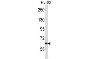 ANKHD1 Antibody (N-term) western blot analysis in HL-60 cell line lysates (35µg/lane). (ANKHD1 antibody  (N-Term))