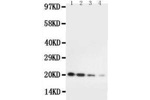 Anti-mouse IL10 antibody, Western blotting Lane 1: Recombinant Mouse IL10 Protein 10ng Lane 2: Recombinant Mouse IL10 Protein 5ng Lane 3: Recombinant Mouse IL10 Protein 2 (IL-10 antibody  (AA 19-178))
