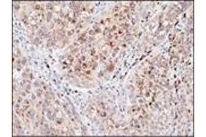 Immunohistochemistry (IHC) image for anti-Melanosome (C-Term) antibody (ABIN870422) (Melanosome (C-Term) antibody)
