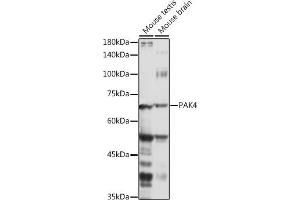Western blot analysis of extracts of various cell lines, using P antibody (ABIN6130472, ABIN6145188, ABIN6145189 and ABIN6215336) at 1:1000 dilution. (PAK4 antibody  (AA 120-280))