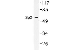 Image no. 1 for anti-Sp2 Transcription Factor (Sp2) antibody (ABIN272208) (Sp2 antibody)