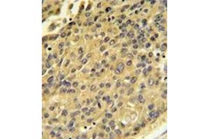 Image no. 1 for anti-Cathepsin H (CTSH) (AA 32-62), (N-Term) antibody (ABIN452890) (Cathepsin H antibody  (N-Term))