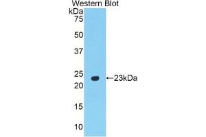 Detection of Recombinant PPARg, Rat using Polyclonal Antibody to Peroxisome Proliferator Activated Receptor Gamma (PPARg) (PPARG antibody  (AA 311-493))