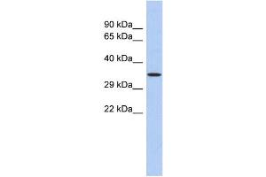 WB Suggested Anti-PRDM12 Antibody Titration: 0. (PRDM12 antibody  (N-Term))