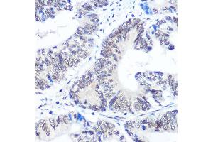 Immunohistochemistry (IHC) image for anti-Small Nuclear Ribonucleoprotein Polypeptides B and B1 (SNRPB) (AA 1-100) antibody (ABIN6148214)