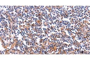 Immunohistochemistry of paraffin-embedded Human tonsil tissue using COL20A1 Polyclonal Antibody at dilution 1:40 (COL20A1 antibody)