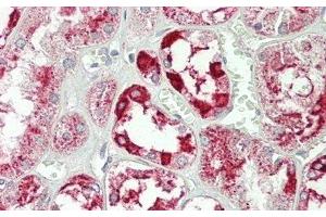 Detection of ANXA4 in Human Kidney Tissue using Polyclonal Antibody to Annexin A4 (ANXA4) (Annexin IV antibody  (AA 165-260))