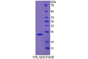 SDS-PAGE (SDS) image for Uroplakin 1a (UPK1A) (AA 116-231) protein (His tag) (ABIN6238880)