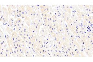 Detection of PAM in Human Cardiac Muscle Tissue using Polyclonal Antibody to Peptidylglycine Alpha Amidating Monooxygenase (PAM) (PAM antibody  (AA 21-288))