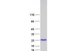 Four and A Half LIM Domains 1 (FHL1) (Transcript Variant 6) protein (Myc-DYKDDDDK Tag)