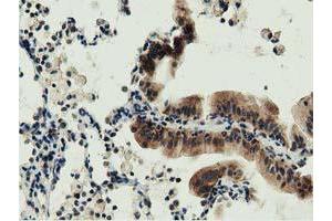 Immunohistochemistry (IHC) image for anti-DnaJ (Hsp40) Homolog, Subfamily A, Member 2 (DNAJA2) antibody (ABIN1497861) (DNAJA2 antibody)