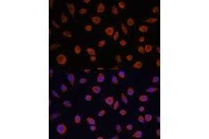 Immunofluorescence analysis of L929 cells using ZCCHC3 antibody (ABIN7271543) at dilution of 1:100. (ZCCHC3 antibody  (AA 215-335))