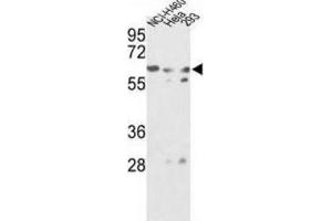 Western Blotting (WB) image for anti-Glucosamine (N-Acetyl)-6-Sulfatase (GNS) antibody (ABIN3002692) (GNS antibody)