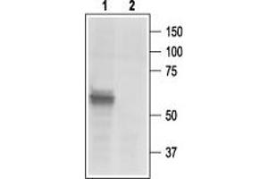 Western blot analysis of rat DRG lysates: - 1. (P2X3 Receptor (AA 383-397), (C-Term), (Intracellular) antibody)