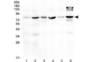 Western blot testing of 1) rat liver, 2) mouse liver, 3) mouse heart, 4) mouse testis, 5) human MCF7 and 6) human HeLa lysate at 0. (HSD17B4 antibody)