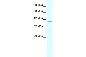 Human Daudi; WB Suggested Anti-HMX1 AntibodyTitration: 5. (HMX1 antibody  (Middle Region))
