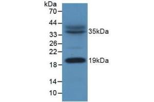 Figure. (NDUFAB1 antibody  (AA 5-129))