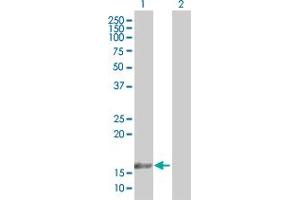 Western Blot analysis of TAF12 expression in transfected 293T cell line by TAF12 MaxPab polyclonal antibody. (TAF12 antibody  (AA 1-161))