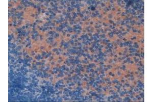 Immunohistochemistry (IHC) image for anti-Transcription Elongation Factor B (SIII), Polypeptide 3 (110kDa, Elongin A) (TCEB3) (AA 76-345) antibody (ABIN7442822)