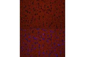 Immunofluorescence (IF) image for anti-Syntaxin Binding Protein 1 (STXBP1) (AA 295-594) antibody (ABIN6148673)