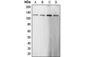 Western blot analysis of CARD6 expression in HeLa (A), Jurkat (B), mouse kidney (C), rat brain (D) whole cell lysates. (CARD6 antibody  (N-Term))