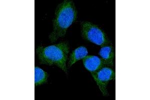 IF analysis of SFRP1 using anti-SFRP1 antibody (ABIN6719484). (SFRP1 antibody)