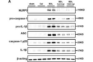 Calcipotriol supplement inhibits the NLRP3 inflammasome activation during DDC-induced and BDL-induced cholestatic liver injury. (NLRP3 antibody  (C-Term))