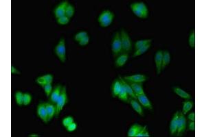 Immunofluorescent analysis of HepG2 cells using ABIN7167217 at dilution of 1:100 and Alexa Fluor 488-congugated AffiniPure Goat Anti-Rabbit IgG(H+L) (RAB1A antibody  (AA 1-196))