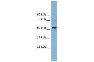 UEVLD antibody used at 1 ug/ml to detect target protein.