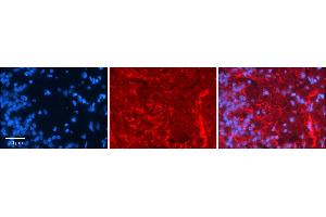 Rabbit Anti-GRIK5 Antibody     Formalin Fixed Paraffin Embedded Tissue: Human Pineal Tissue  Observed Staining: Membrane in cell processes  Primary Antibody Concentration: 1:100  Other Working Concentrations: 1/600  Secondary Antibody: Donkey anti-Rabbit-Cy3  Secondary Antibody Concentration: 1:200  Magnification: 20X  Exposure Time: 0. (GRIK5 antibody  (Middle Region))