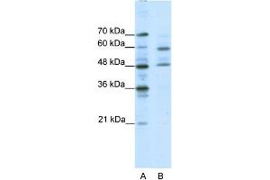 Human Jurkat; WB Suggested Anti-TFCP2L1 Antibody Titration: 0. (TFCP2L1 antibody  (Middle Region))