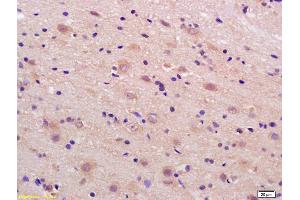 Formalin-fixed and paraffin embedded rat brain labeled with Rabbit Anti phospho-LRP1(Ser4523) Polyclonal Antibody, Unconjugated (ABIN801648) at 1:200 followed by conjugation to the secondary antibody and DAB staining (LRP1 antibody  (pSer4523))