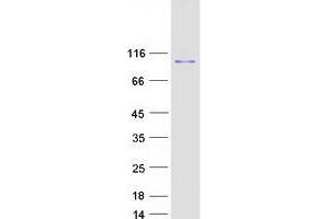 Validation with Western Blot (SSRP1 Protein (Myc-DYKDDDDK Tag))