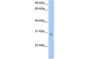Western Blotting (WB) image for anti-DCN1, Defective in Cullin Neddylation 1, Domain Containing 3 (DCUN1D3) antibody (ABIN2463546) (DCUN1D3 antibody)