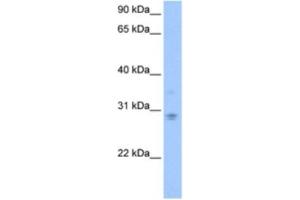 Western Blotting (WB) image for anti-DCN1, Defective in Cullin Neddylation 1, Domain Containing 3 (DCUN1D3) antibody (ABIN2463546) (DCUN1D3 antibody)