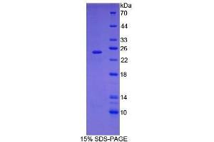 SDS-PAGE (SDS) image for Signal Transducer and Activator of Transcription 3 (Acute-Phase Response Factor) (STAT3) (AA 346-552) protein (His tag) (ABIN2122086)