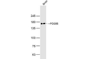 Mouse brain lysates probed with PDS5B Polyclonal Antibody, Unconjugated  at 1:300 dilution and 4˚C overnight incubation. (PDS5B antibody  (AA 1051-1150))