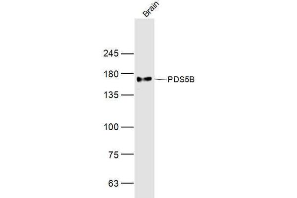PDS5B antibody  (AA 1051-1150)