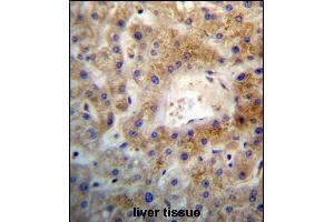 SGEF Antibody (Center) (ABIN657248 and ABIN2846346) immunohistochemistry analysis in formalin fixed and paraffin embedded human liver tissue followed by peroxidase conjugation of the secondary antibody and DAB staining.