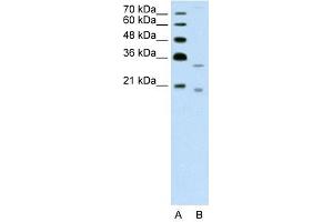 DNASE2B antibody used at 1. (DNASE2B antibody  (C-Term))