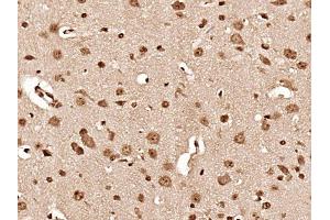 Paraformaldehyde-fixed, paraffin embedded mouse brain, Antigen retrieval by boiling in sodium citrate buffer (pH6) for 15min, Block endogenous peroxidase by 3% hydrogen peroxide for 30 minutes, Blocking buffer (normal goat serum) at 37°C for 20min, Antibody incubation with Hsc70 Polyclonal Antibody at 1:400 overnight at 4°C, followed by a conjugated secondary and DAB staining. (Hsc70 antibody  (AA 501-600))