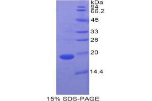 SDS-PAGE analysis of Pig RBP7 Protein.