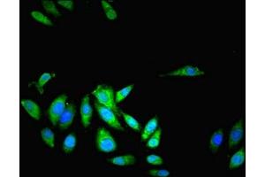 Immunofluorescent analysis of Hela cells using ABIN7158066 at dilution of 1:100 and Alexa Fluor 488-congugated AffiniPure Goat Anti-Rabbit IgG(H+L) (LRRFIP1 antibody  (AA 1-315))