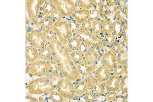 Immunohistochemistry of paraffin-embedded mouse kidney using MOCS3 antibody at dilution of 1:100 (x400 lens). (MOCS3 antibody)