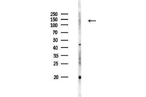 anti-Janus Kinase 2 (JAK2) (C-Term) antibody