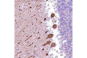 Immunohistochemical staining of human cerebellum with FUZ polyclonal antibody  shows strong cytoplasmic positivity in purkinje cells. (FUZ antibody)