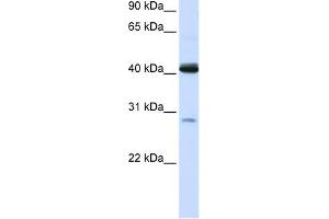 GCDH antibody used at 1 ug/ml to detect target protein.
