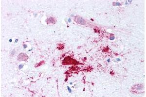 Human Brain, Alzheimers (formalin-fixed, paraffin-embedded) stained with BACE1 antibody ABIN213580 at 2. (BACE1 antibody  (N-Term))