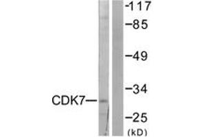 Western blot analysis of extracts from 293 cells, using CDK7 Antibody. (CDK7 antibody  (AA 291-340))